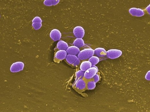 Enterococcus faecalis 粪肠球菌 CICC 10396