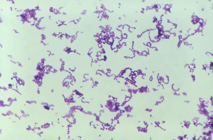 Peptostreptococcus anaerobius 消化链球菌  ATCC 27337