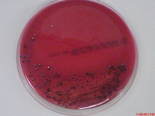 Porphyromonas gingivalis 牙龈卟啉单胞菌 ATCC 33277